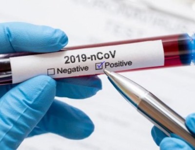 coronavirus_test.2e16d0ba-1590807918.jpg